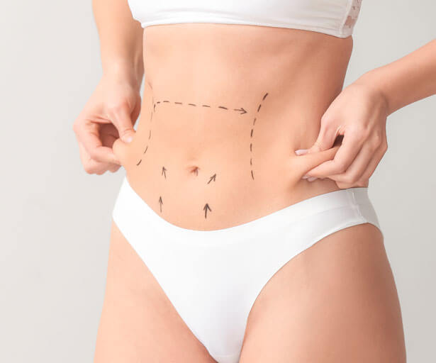 شفط الدهون بدون عملية (بدون جراحة)