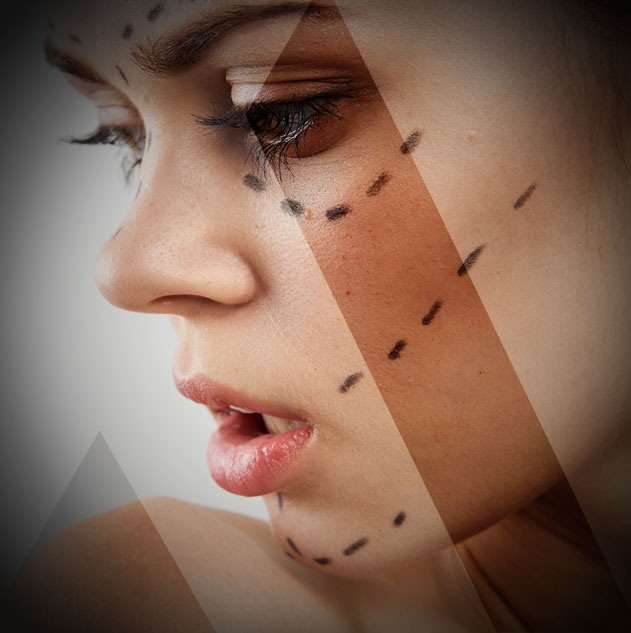 الذقن المزدوج