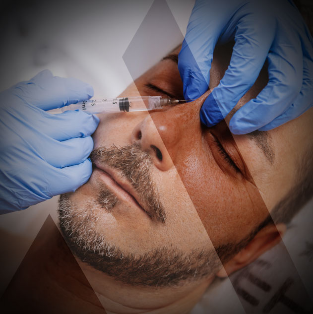 عملية تجميل الانف