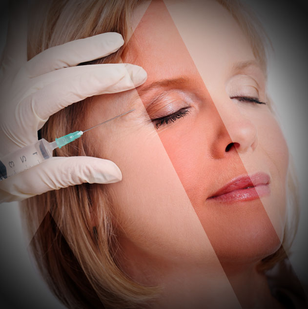 ترهل الجفون