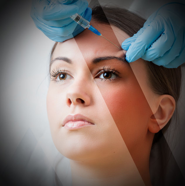 تدلي الجفون